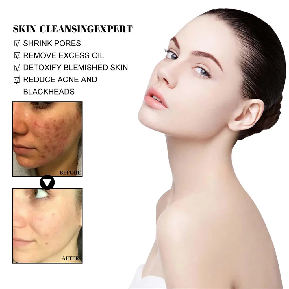 West Month Blackhead Mud Mask Oil Control Treatment